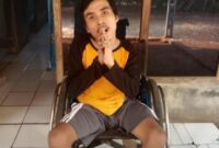 Foto : Anak kedua bernama Nana Sutisna yang membutuhkan bantuan Bupati Bekasi dan Gubernur Jawa Barat untuk perawatan dan pengobatan