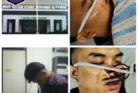 Foto : Penganiayaan berat yang menimpa Andrea, putra dari Pimpinan Nuusantara News Iskandar