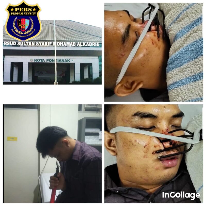 Foto : Penganiayaan berat yang menimpa Andrea, putra dari Pimpinan Nuusantara News Iskandar